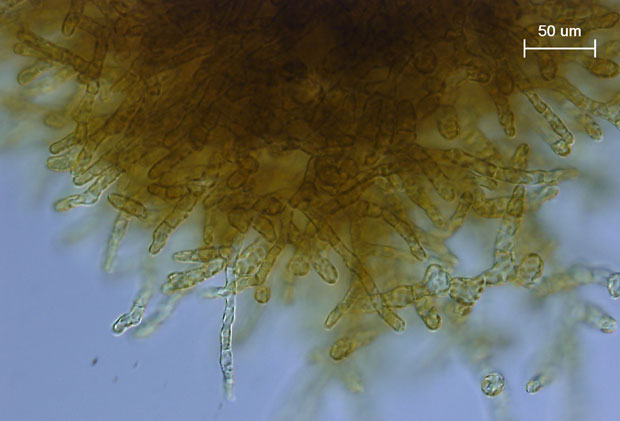 Морские водоросли в медицине